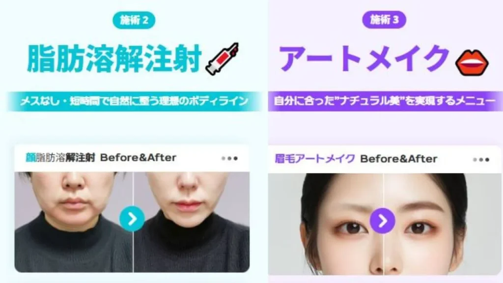 効果的な施術の順番