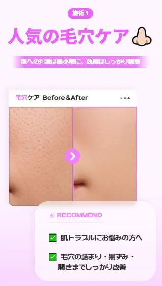 毛穴やニキビ跡のケア
